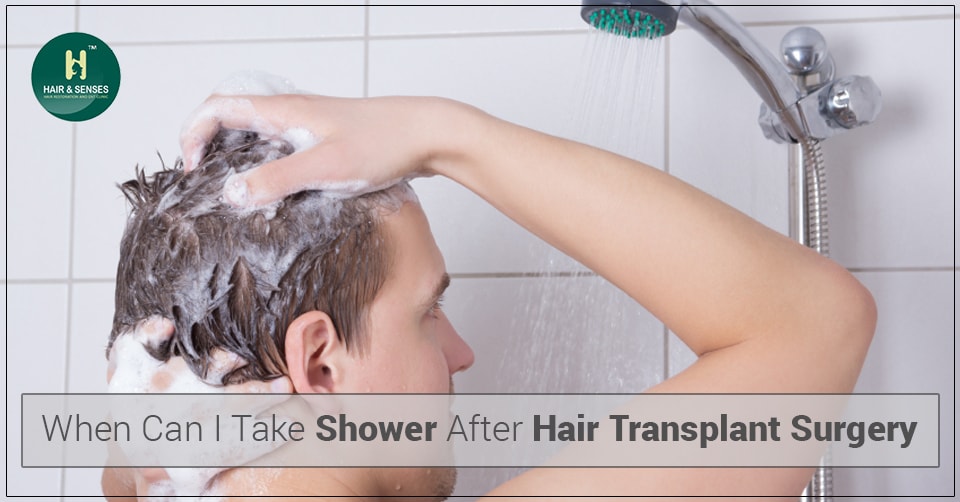 Shower After Hair Transplant