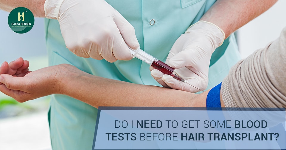 Do I need to get some blood tests before hair transplant?