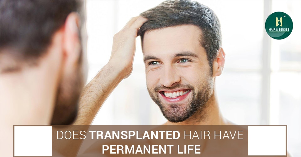 Life of Hair Transplant