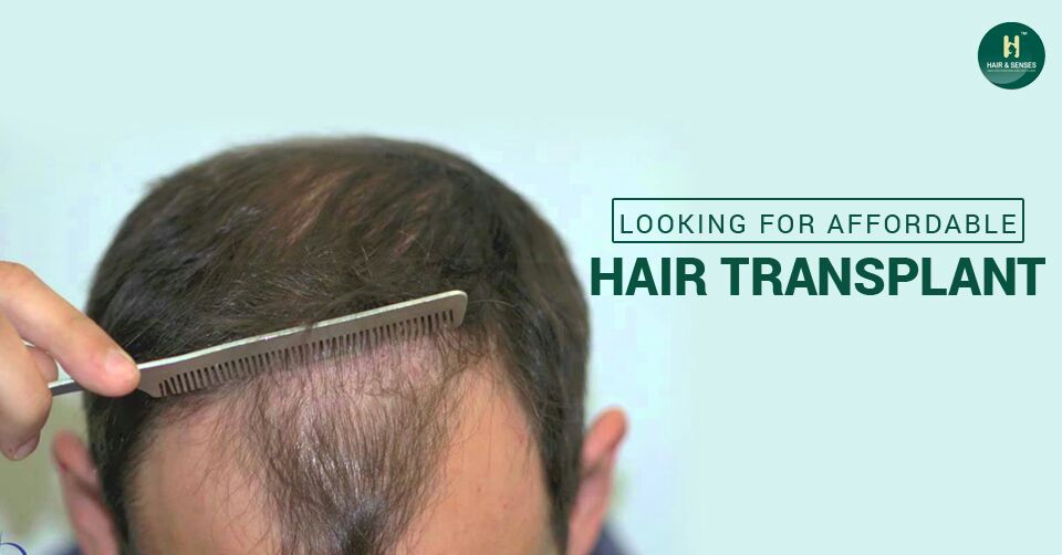 Affordable hair transplant