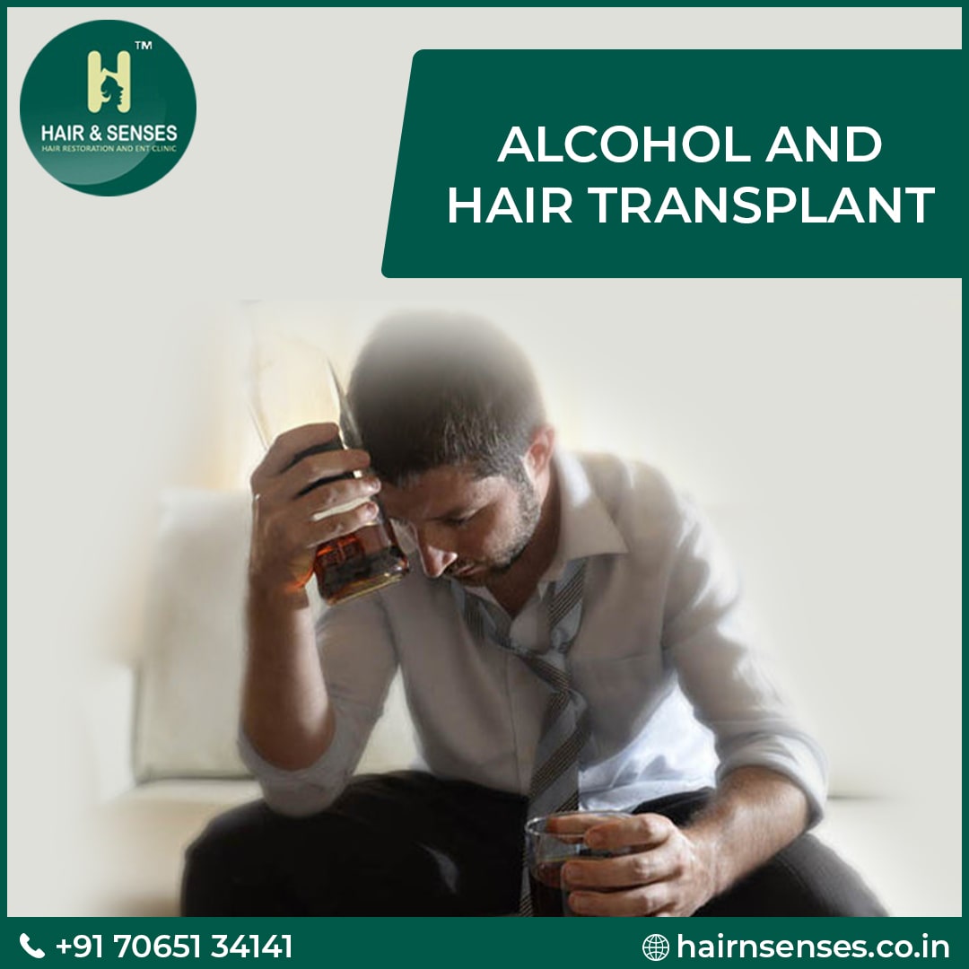 Alcohol and hair transplant