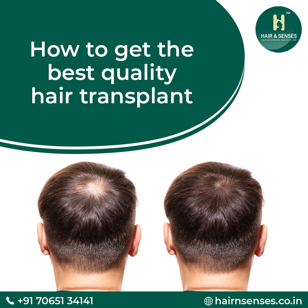 Hair Transplant Tips