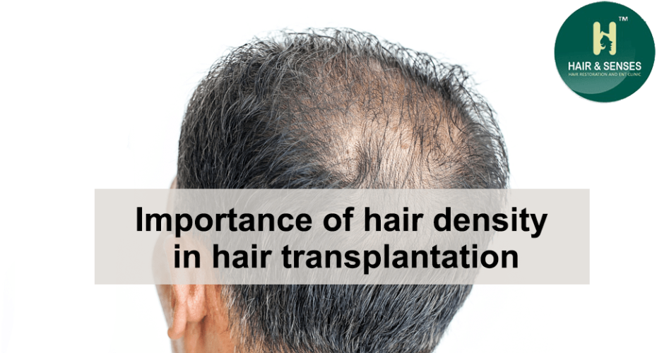 Importance of hair density in hair transplantation