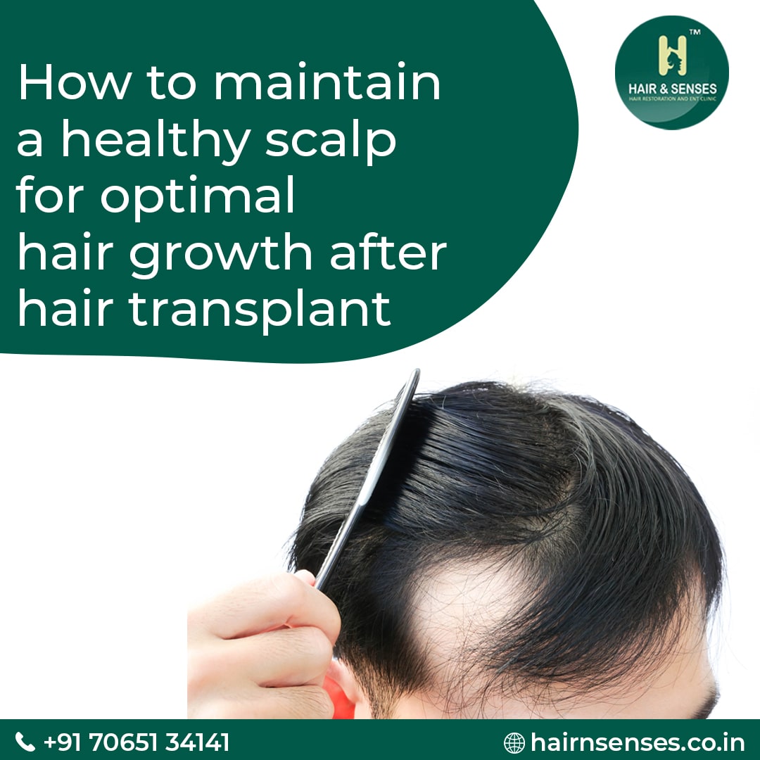 Hair Transplant Tips