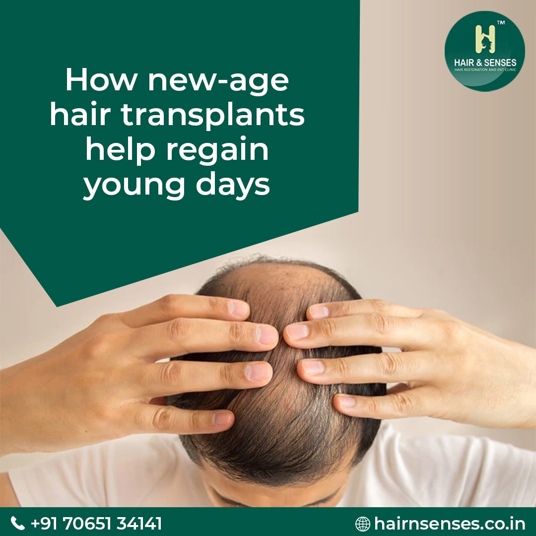 Hair Transplant Tips