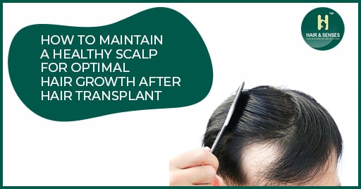 skills of hair transplant