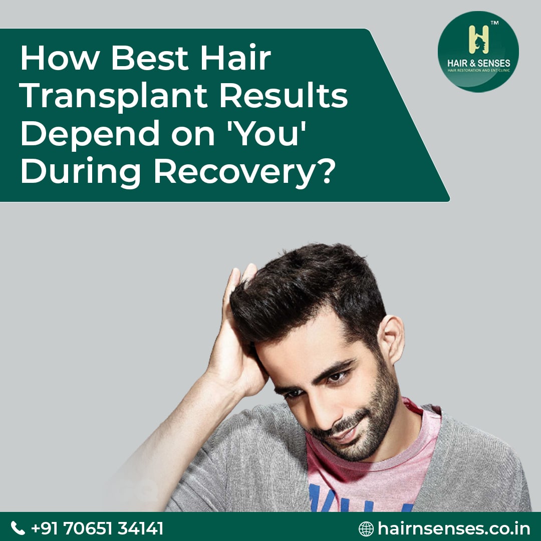 Hair Transplant Tips