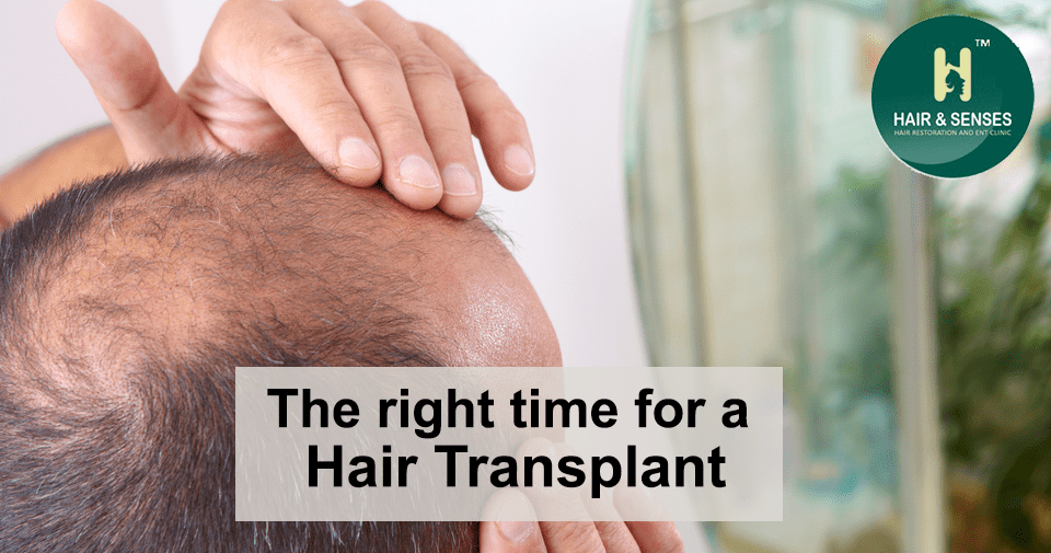 Right time for Hair Transplant