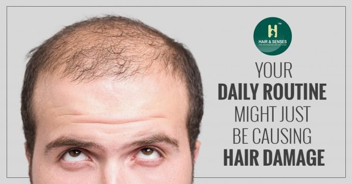 Hair Loss Routine