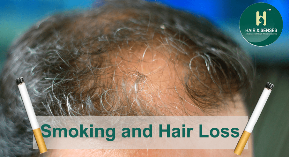 Smoking and hair loss