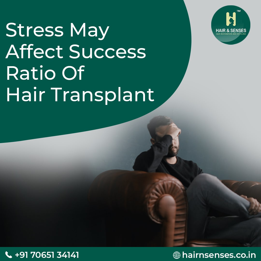 Hair Transplant Tips