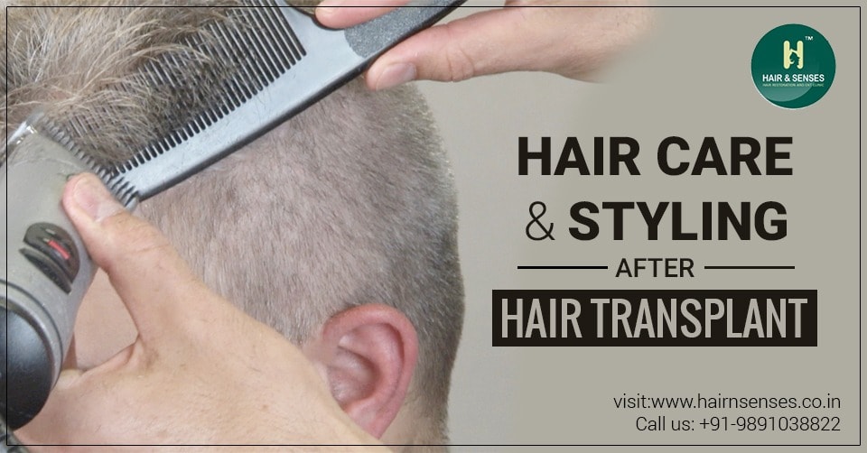 Get Hair Transplantation for Different Hairstyles