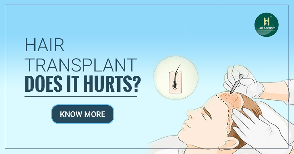 Hair Transplant – Does it hurts? | Is Hair Transplant Surgery Painful