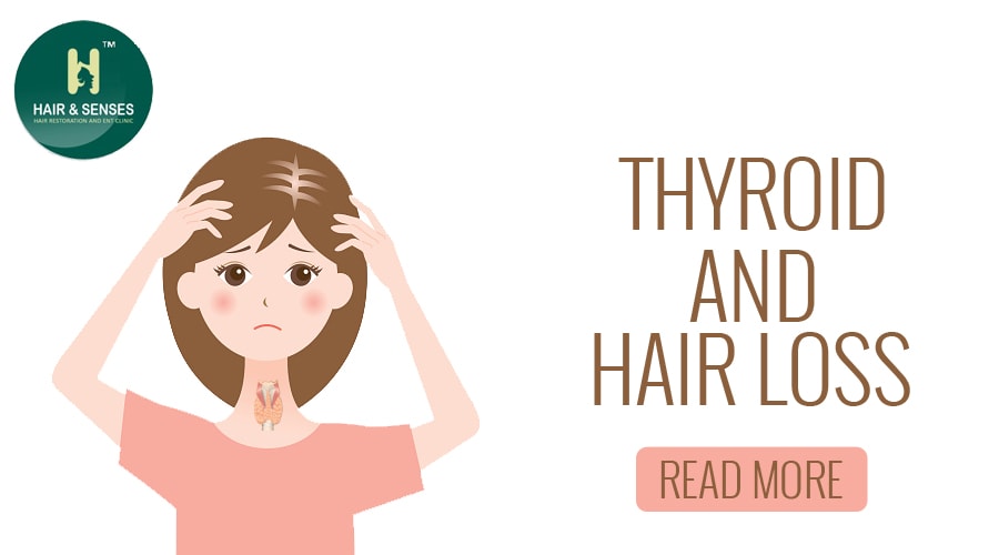 Thyroid and Hair loss